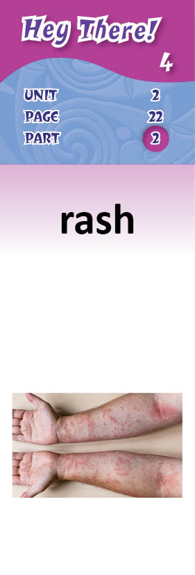 images/rash_HEx4nQ6.jpg